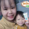 Mẹ đảm chia sẻ bí quyết chăm bé bị hăm ngứa, muỗi, côn trùng đốt