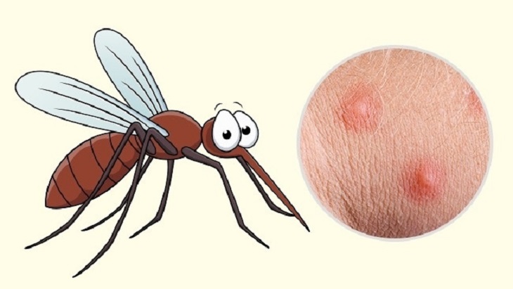  làm gì để xử lý vết muỗi đốt, côn trùng cắn