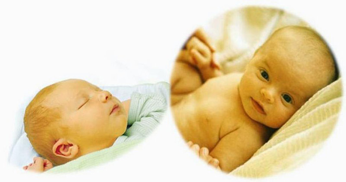 Da, mắt hoặc toàn thân trẻ có màu vàng là các dấu hiệu nhận biết bệnh vàng da ở trẻ sơ sinh