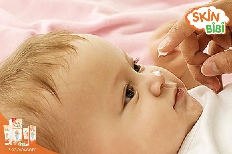 Kinh nghiệm xương máu khi lựa chọn kem bôi chăm sóc da cho trẻ