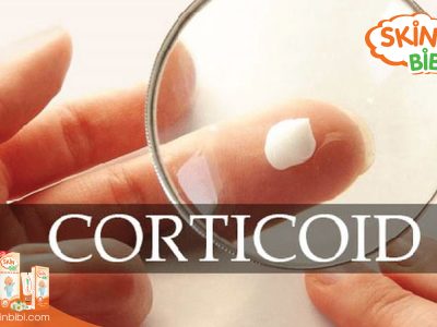 Xác định mức độ nhiễm độc corticoid trên da trẻ bằng 5 cấp độ